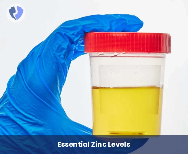 24-Hour Urine Zinc Test