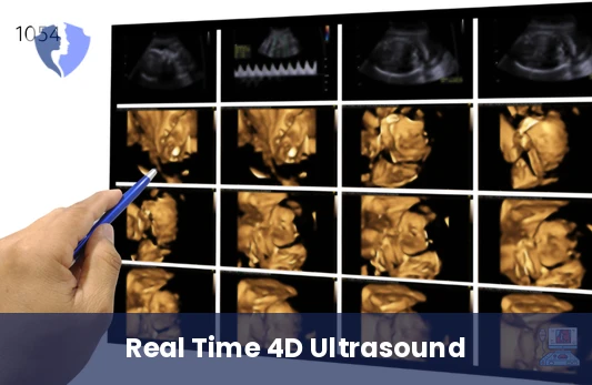 4D Ultrasound Scan