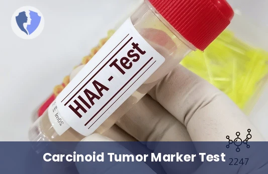 Gastrointestinal Tumor Detection - 5-Hydroxyindoleacetic Acid (5-HIAA) Urine Test