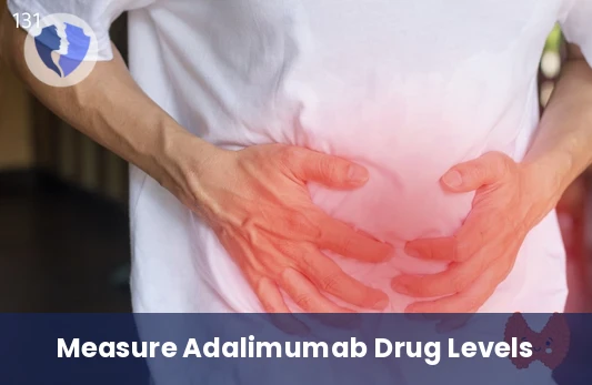 Adalimumab Therapy Monitor - Adalimumab Level Test