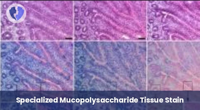 Alcian Blue Special Stain