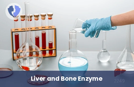 Alkaline Phosphatase Source Test - Alkaline Phosphatase Isoenzymes Test
