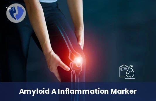 Amyloid A Health Insight - Amyloid A (AA) Test