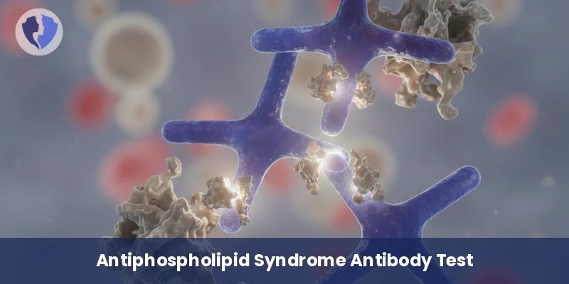 Anti-Beta-2-Glycoprotein IgM Test - Anti-Beta-2-Glycoprotein I Antibodies (IgM)