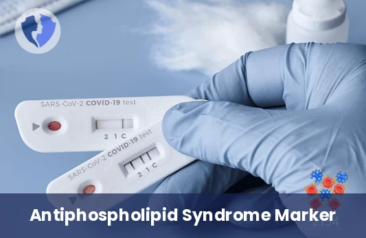 Anti-Cardiolipin IgM Test - Anti-Cardiolipin IgM Antibodies Test