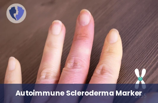 Anti-Centromere Test - Anti-Centromere Antibodies Test