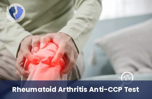 Early Rheumatoid Arthritis Check - Anti-Cyclic Citrullinated Peptide (Anti-CCP) IgG Test