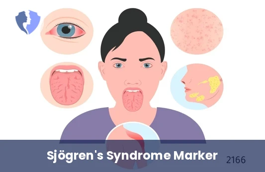 Sjögren's Syndrome Test - Anti-La (SS-B) Antibodies Test