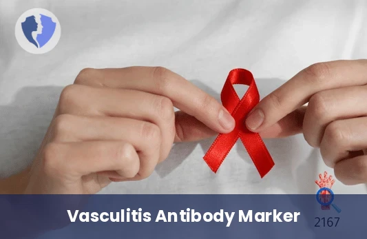 Vasculitis MPO Test - Anti-Myeloperoxidase (MPO) Antibodies Test