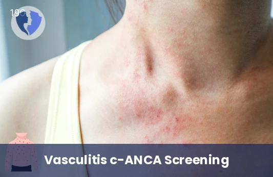 Vascular Inflammation Test - Anti-Neutrophil Cytoplasmic Antibodies (PR3 c-ANCA) Test