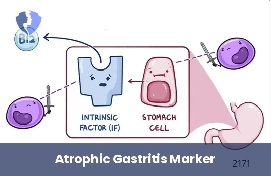 Anti-Parietal Cell Antibodies (APCA) Test
