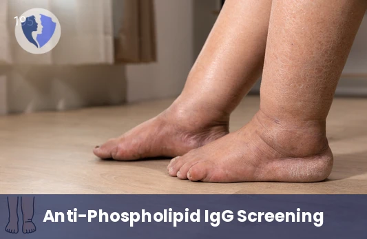 Blood Clotting Risk Test - Anti-Phospholipid IgG Antibodies Test