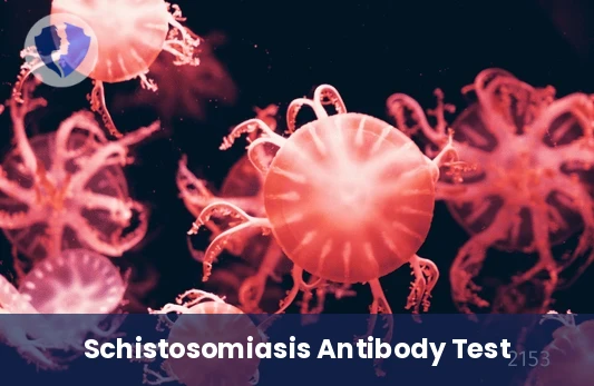 Schistosomiasis Antibody Test - Anti-Schistosomal Antibodies Test