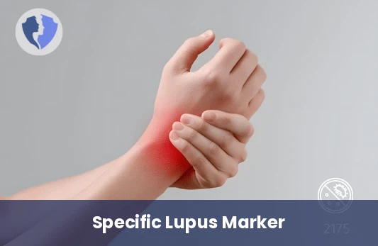 Anti-Smith (Sm) Test - Anti-Smith Antibodies Test