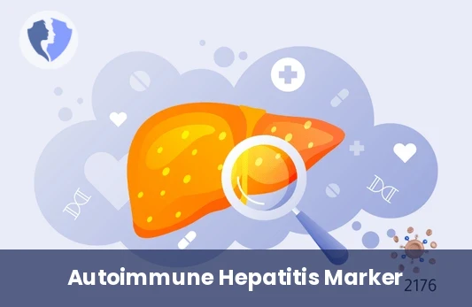 Anti-SLA Liver Test - Anti-Soluble Liver Antigen (SLA) Antibodies Test
