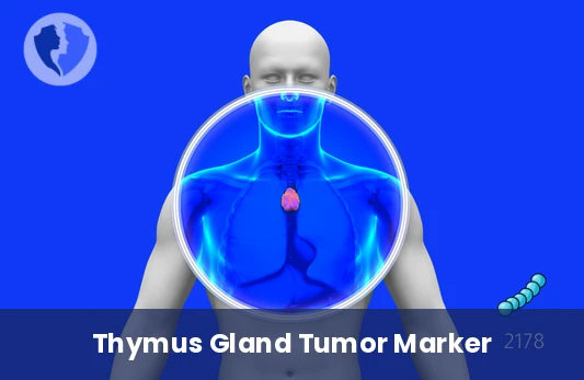 Thymoma & Muscle Antibody Test - Anti-Striated Muscle Antibodies (IFA) Test