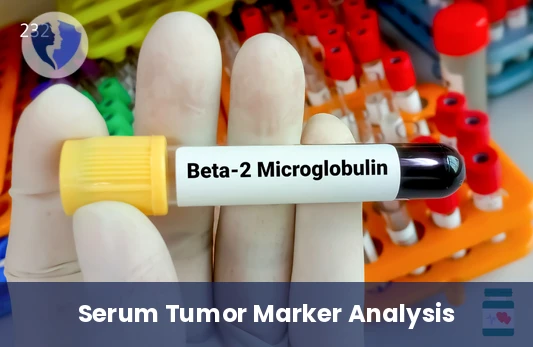 Beta-2-Microglobulin Serum Test