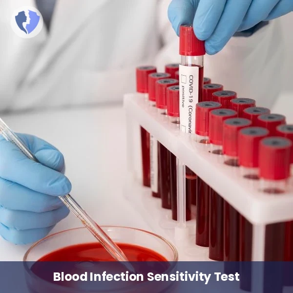 Blood Culture & Sensitivity - Blood Culture and Sensitivity