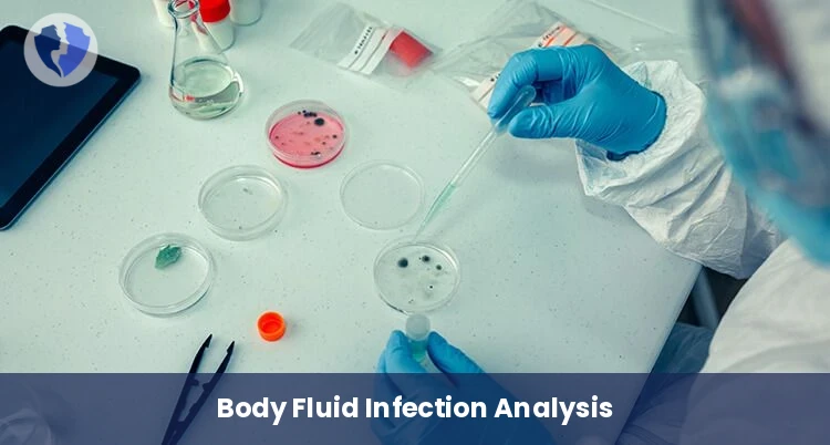 Body Fluid Culture Test - Body Fluid Culture and Sensitivity