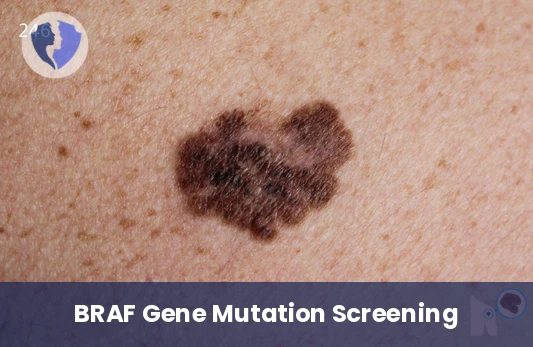 BRAF Gene Mutation Test