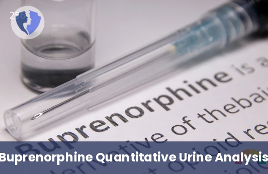 Track Your Medication Precisely - Buprenorphine and Metabolite Quantitative Urine Test
