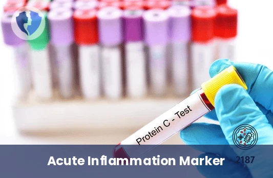 C-Reactive Protein (CRP) Test