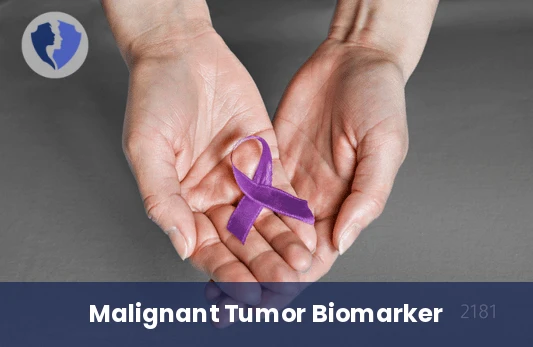 CA 50 Cancer Marker Test - Cancer Antigen 50 (CA 50) Test