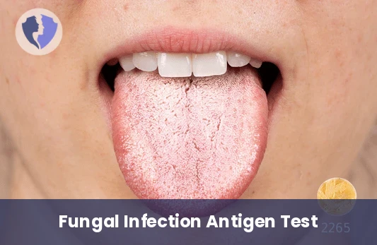 Systemic Candida Antigen Test - Candida Soluble Antigen Test