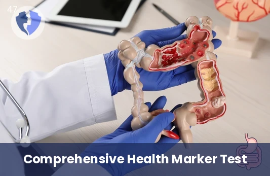 Early Tumor Marker Screening - Carcinoembryonic Antigen (CEA) Test