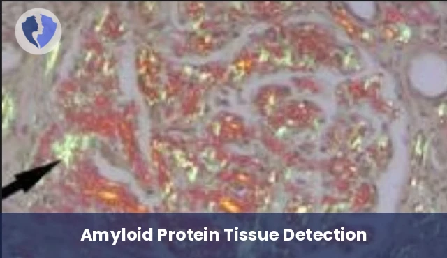 Congo Red Special Stain