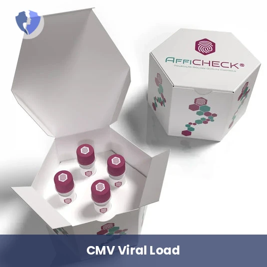 CMV Quantitative PCR Test - Cytomegalovirus (CMV) DNA Quantitative PCR Test