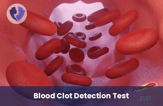 D-Dimer Clot Test - D-Dimer Test