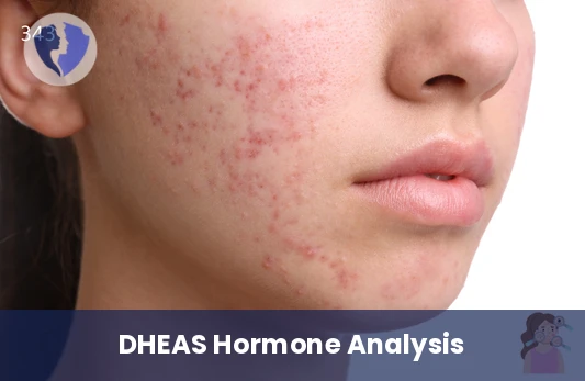 Adrenal Hormone Balance Test - Dehydroepiandrosterone Sulfate (DHEAS) Test