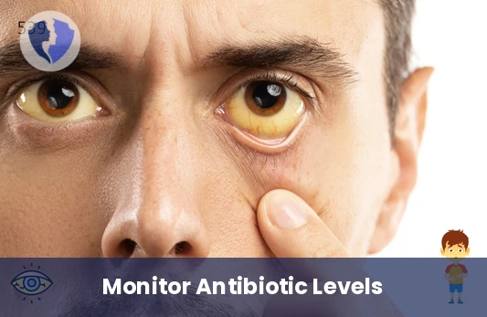 Monitor Your Doxycycline Therapy - Doxycycline Level Test