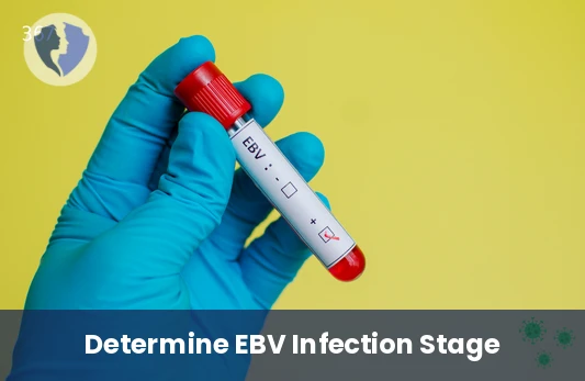 Detect Active Epstein-Barr Infection - EBV Nuclear Antigen IgM Test