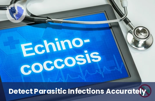 Echinococcus Antibody Test - Echinococcus Antibody Serum Test