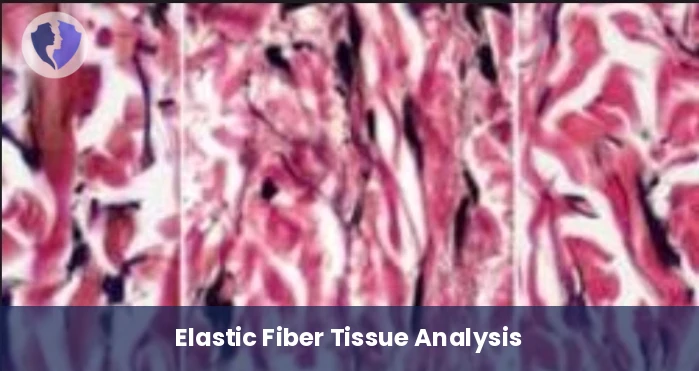 Elastic Fiber Special Stain