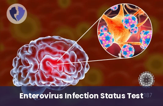 Enterovirus Antibody Screening - Enterovirus Antibodies (IgG & IgM) Test