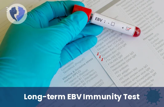Check Your Epstein-Barr Immunity - Epstein-Barr Virus (EBV) IgG Antibody Test