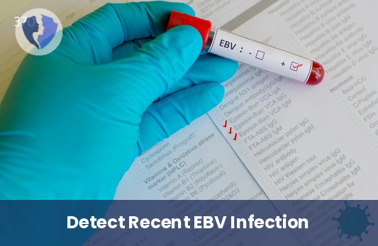 Early Epstein-Barr Virus Detection - Epstein-Barr Virus (EBV) IgM Antibody Test