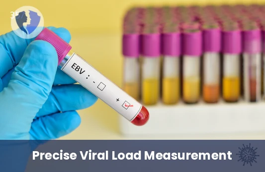 EBV Quantitative PCR Test - Epstein-Barr Virus (EBV) Quantitative PCR Test