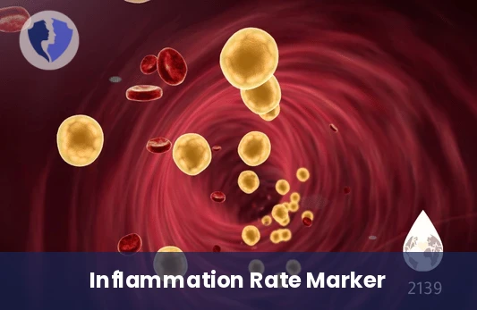 ESR Inflammation Test - Erythrocyte Sedimentation Rate (ESR)