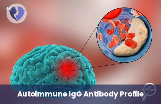Gangliosides IgG Profile Test - Gangliosides (IgG) Profile Test