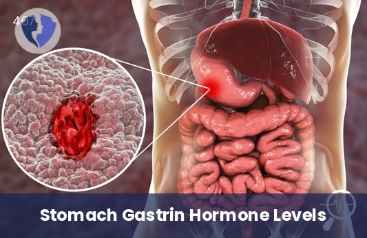 Gastrin Hormone Balance Test - Gastrin Hormone Test