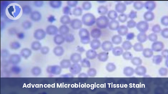 Giemsa Special Stain