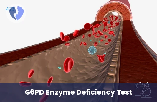 G6PD Deficiency Shield Test - Glucose-6-Phosphate Dehydrogenase (G6PD) Test
