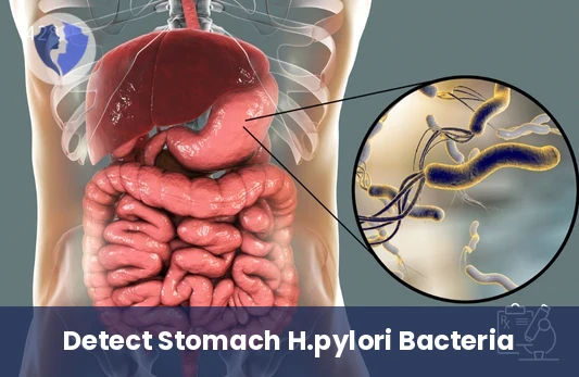 H. Pylori Stool Antigen Test - Helicobacter pylori Antigen Stool Test