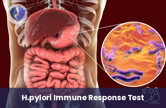 H. Pylori IgA Antibody Shield - Helicobacter pylori IgA Antibody Test