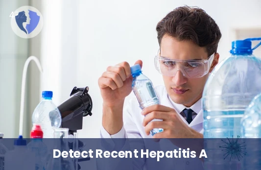 Acute Hepatitis A Test - Hepatitis A Virus IgM Antibody Test