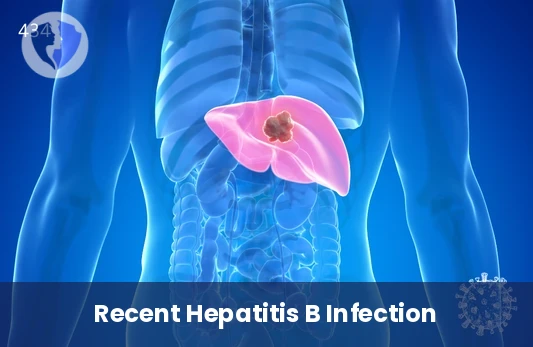 Early Hepatitis B Detection - Hepatitis B Core Antibody IgM Test